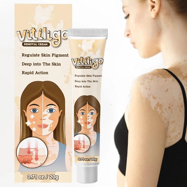 Crema para vertiligo