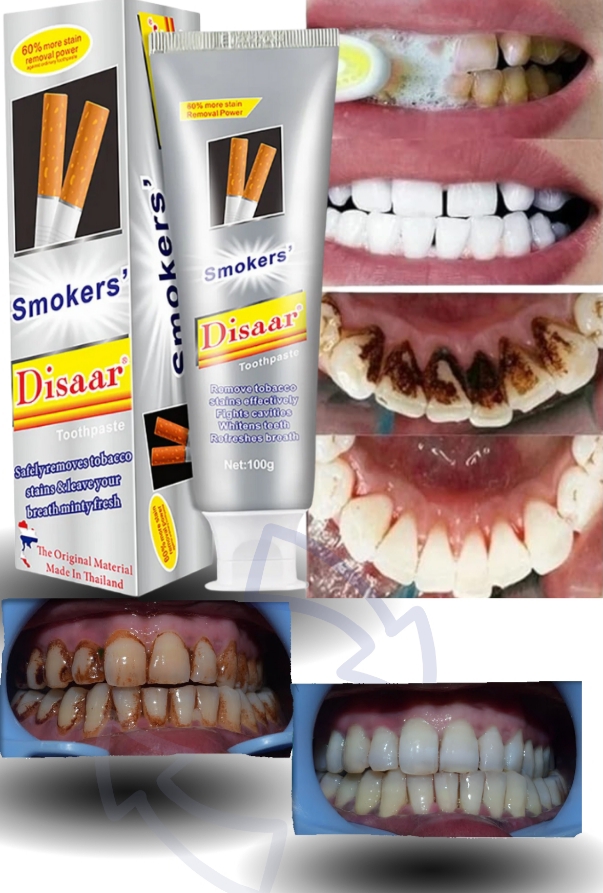 Blanqueador Dental SMOKERS Disaar